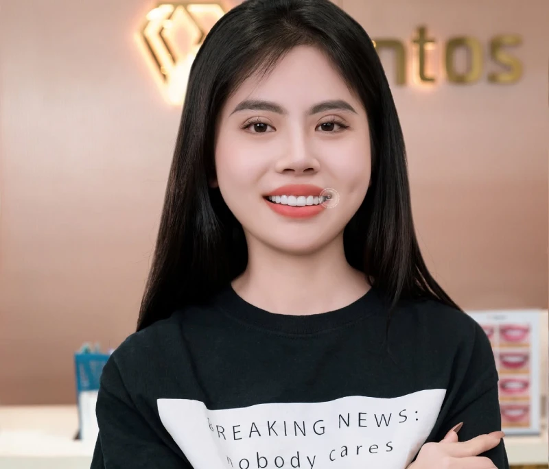 Giá bọc răng sứ bao nhiêu tiền & Loại nào tốt nhất hiện nay?