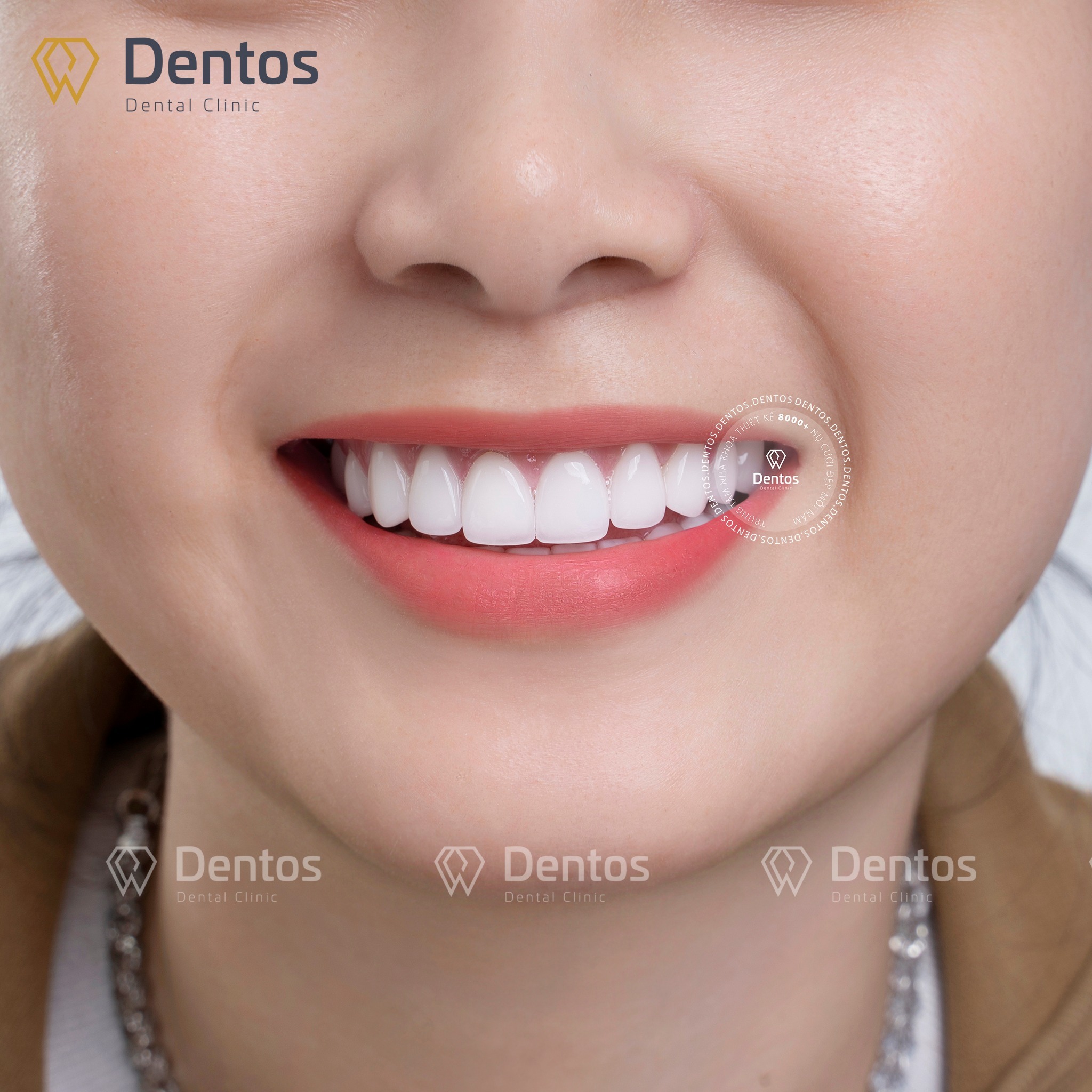 Răng Miệng Sạch Sẽ, Nướu Khỏe Mạnh