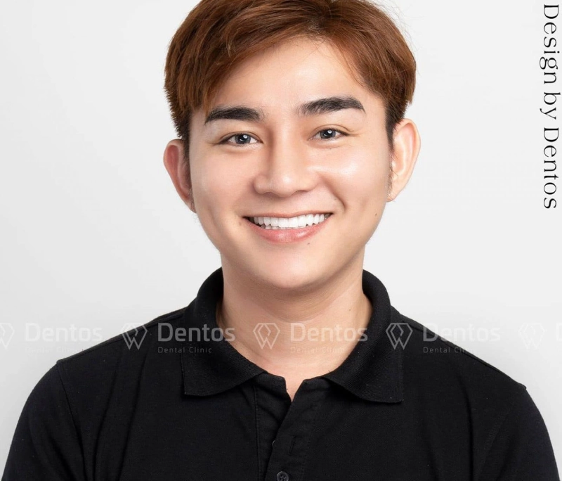 Khách hàng Long Phi hoàn thiện vẻ điển trai cùng nụ cười Dentos