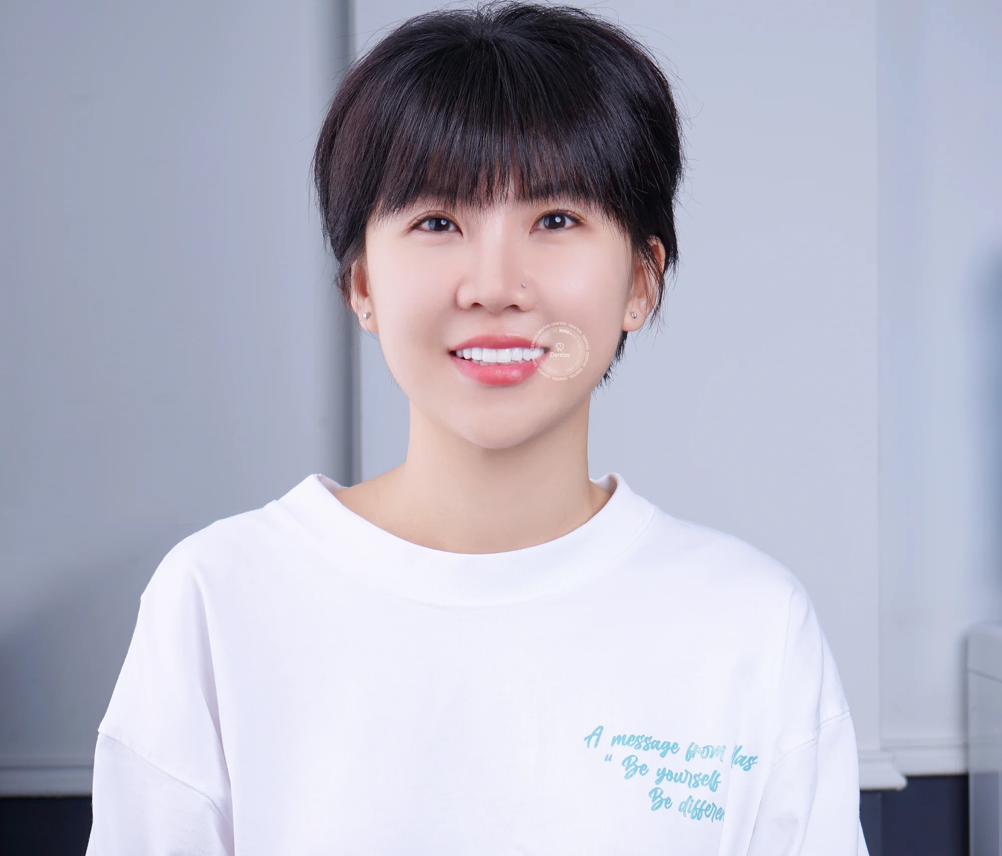 Các màu răng sứ đẹp và bí quyết chọn màu phù hợp nhất