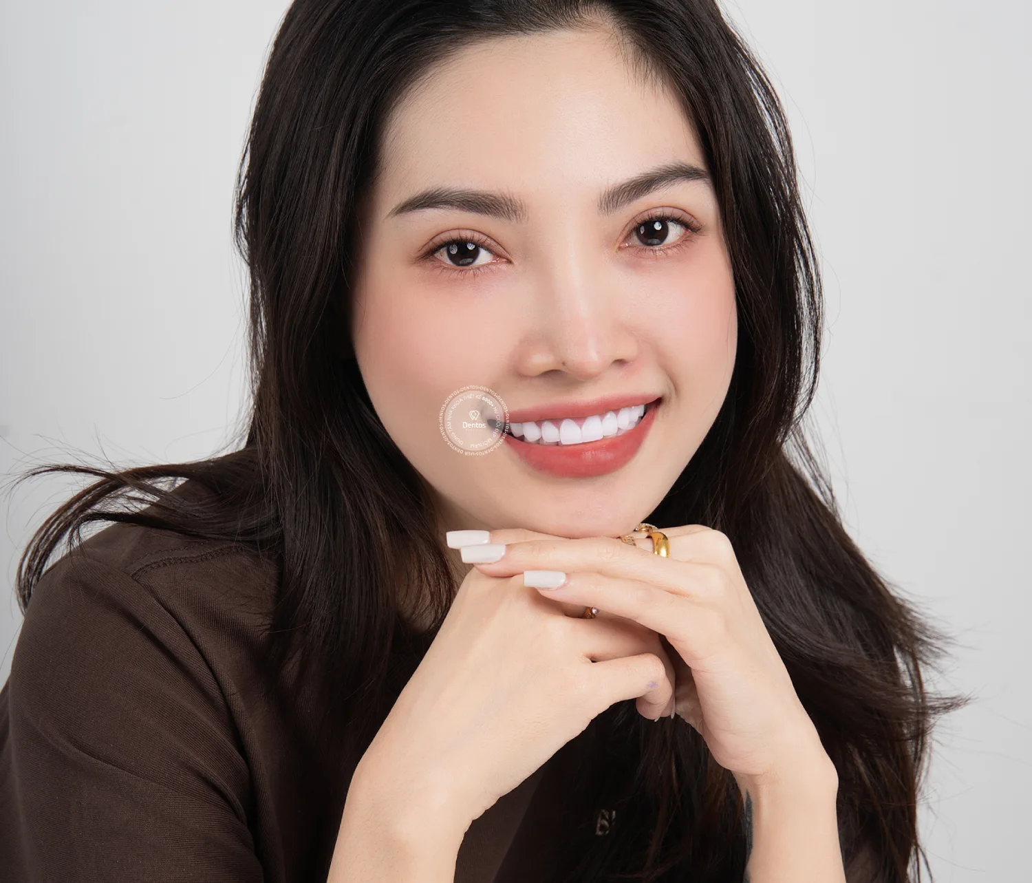 Góc giải đáp: Vì sao nên bọc răng sứ thẩm mỹ?