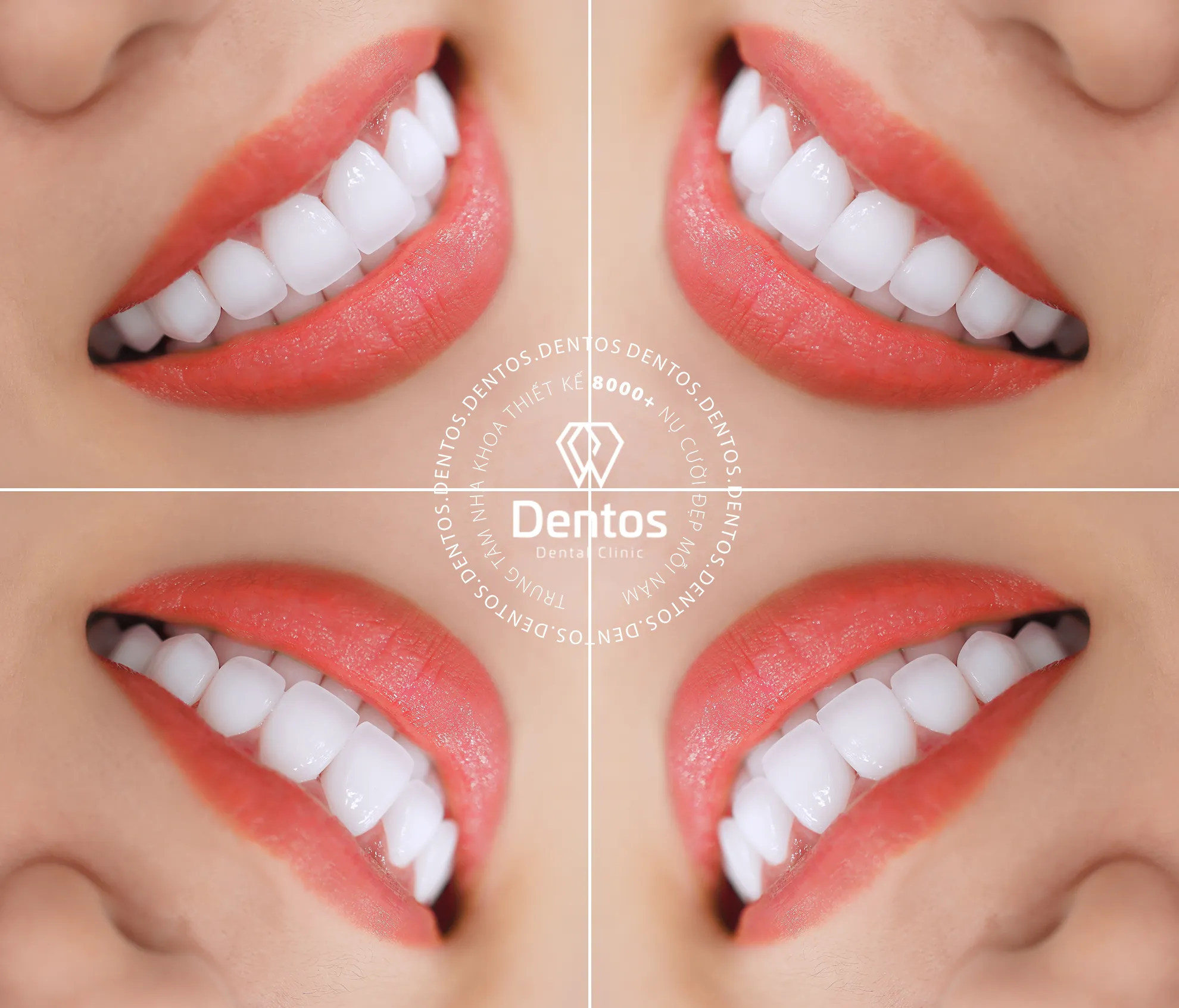 Làm răng sứ xong có ăn uống bình thường được không?