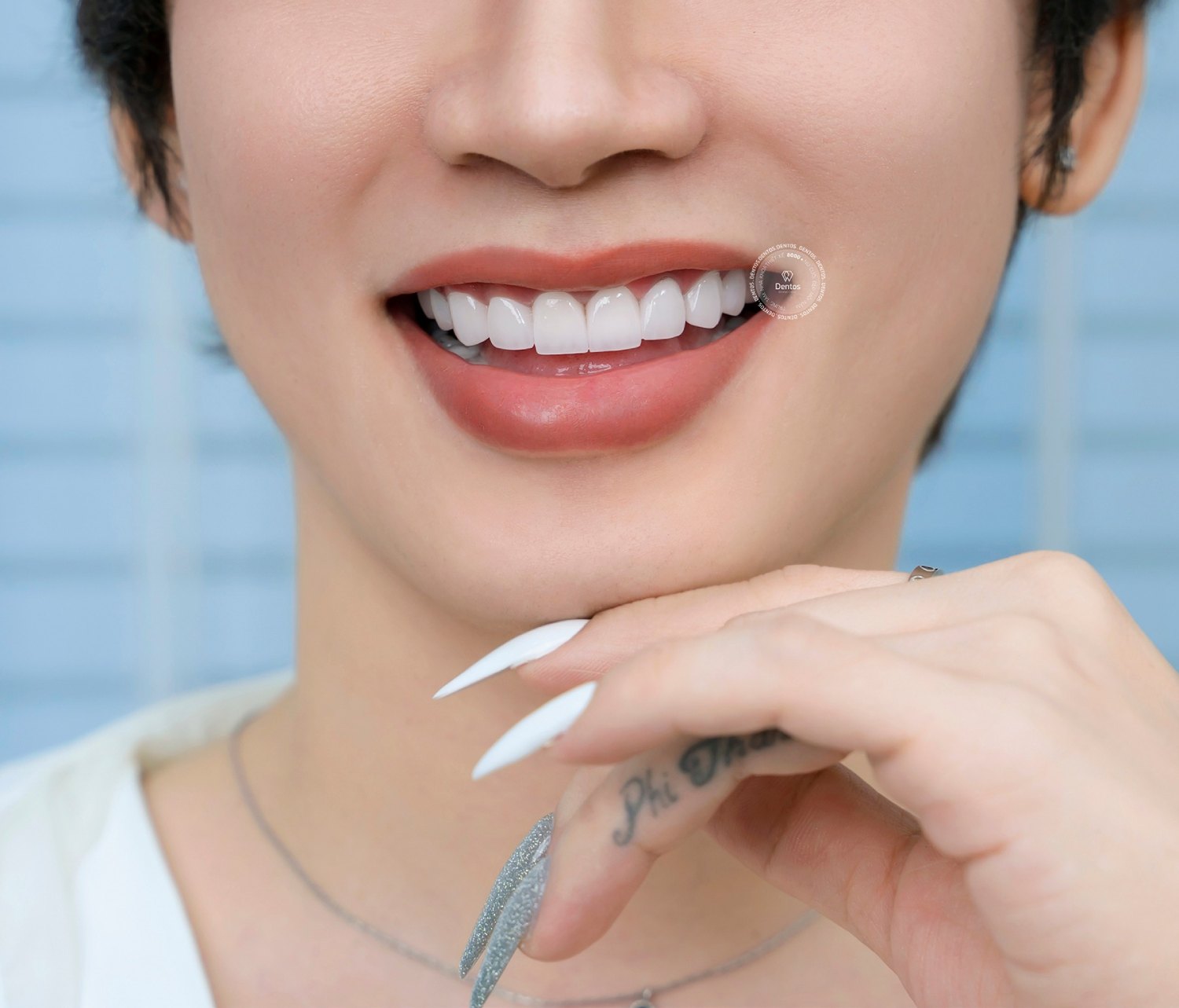 Bọc răng sứ có ăn đồ cứng được không?