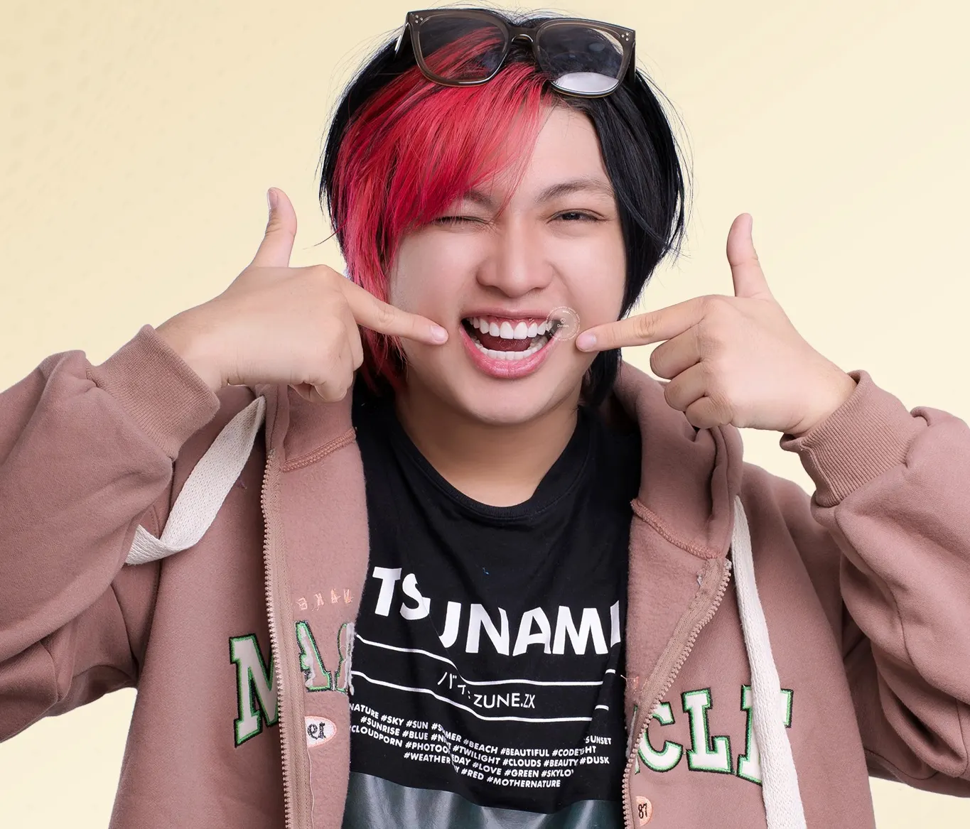 Dán mặt sứ veneer là gì? Ưu điểm nổi bật và chi phí dán