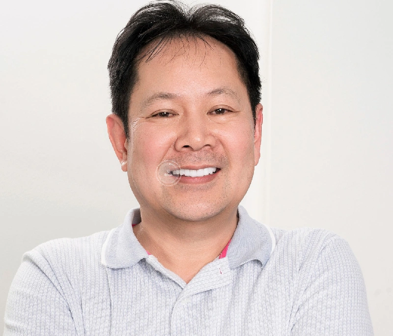 Làm răng sứ khi về già có bền không? Có gây rụng răng không?