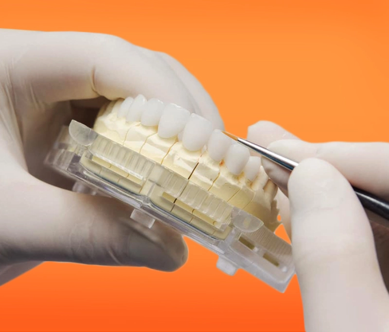 Răng toàn sứ là gì? Có mấy loại? Chi phí bọc mới nhất 2025