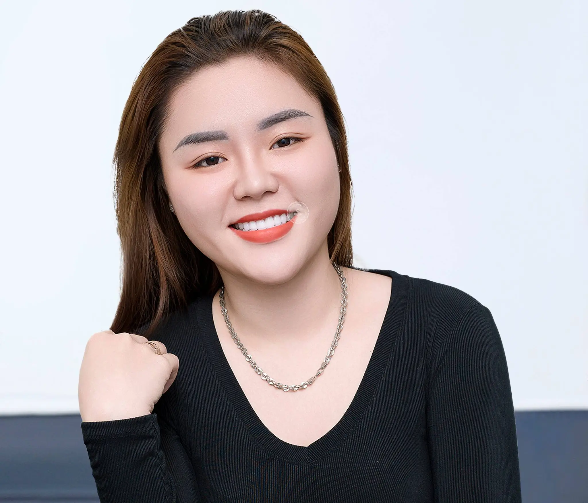 Răng sứ bị hở có sao không? Khắc phục thế nào?