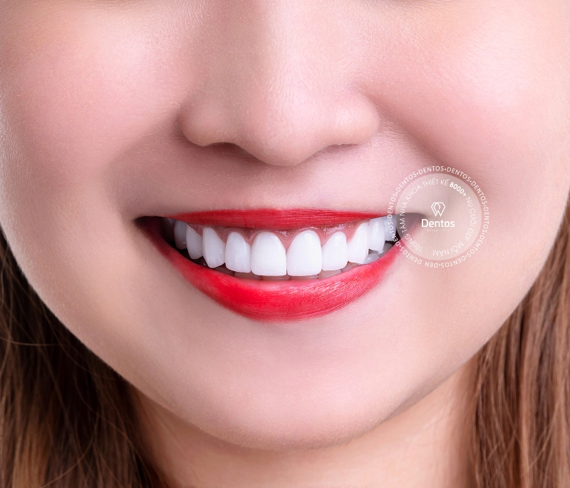 Răng lung lay bọc răng sứ được không?