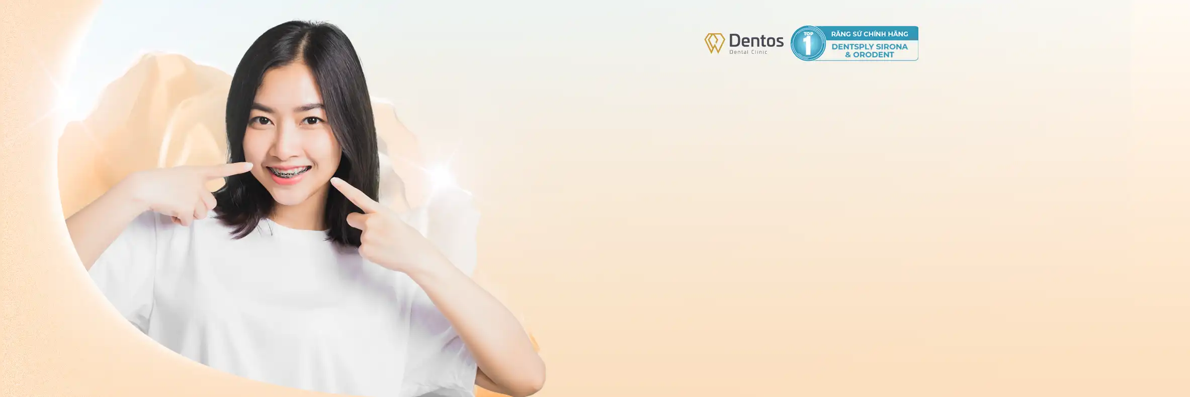 Niềng Răng Thẩm Mỹ