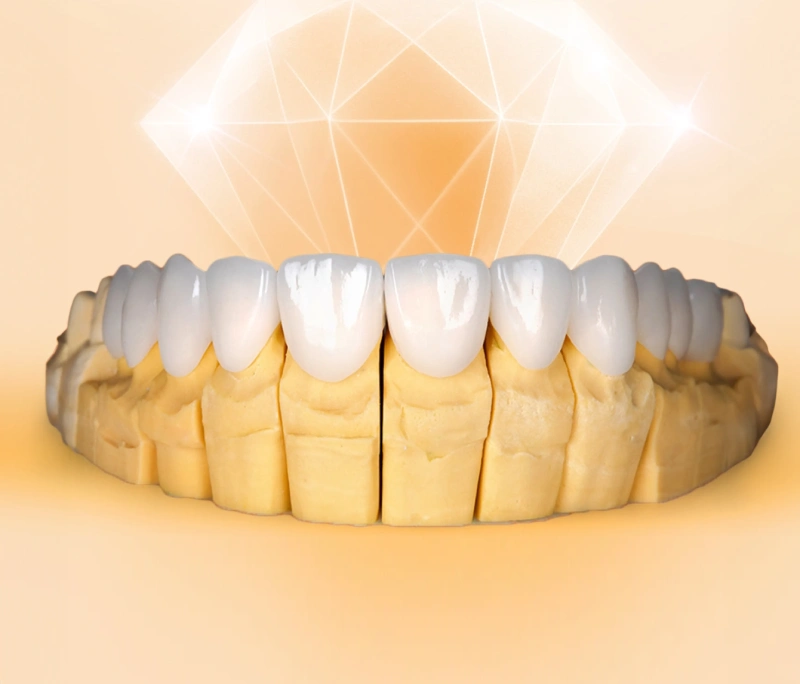 Bọc răng sứ giá bao nhiêu 1 hàm? Cách tính & Bảng giá ưu đãi