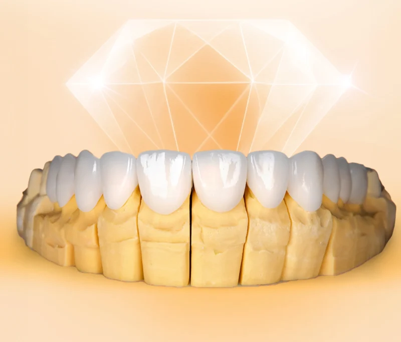 Bọc sứ nguyên hàm giá bao nhiêu? Khi nào nên thực hiện?