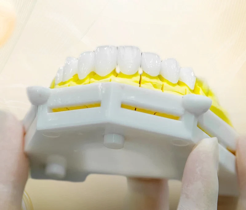 Bọc răng sứ giá bao nhiêu 1 chiếc? Có đau và gây hôi miệng không?