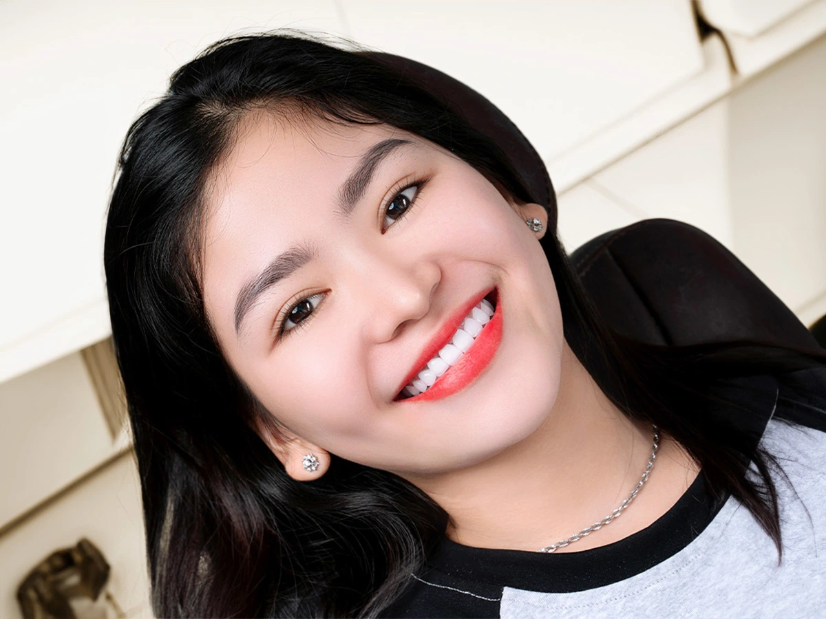 Tại Dentos: Tẩy Trắng Không Chỉ Đẹp, Mà Còn Phải Khỏe