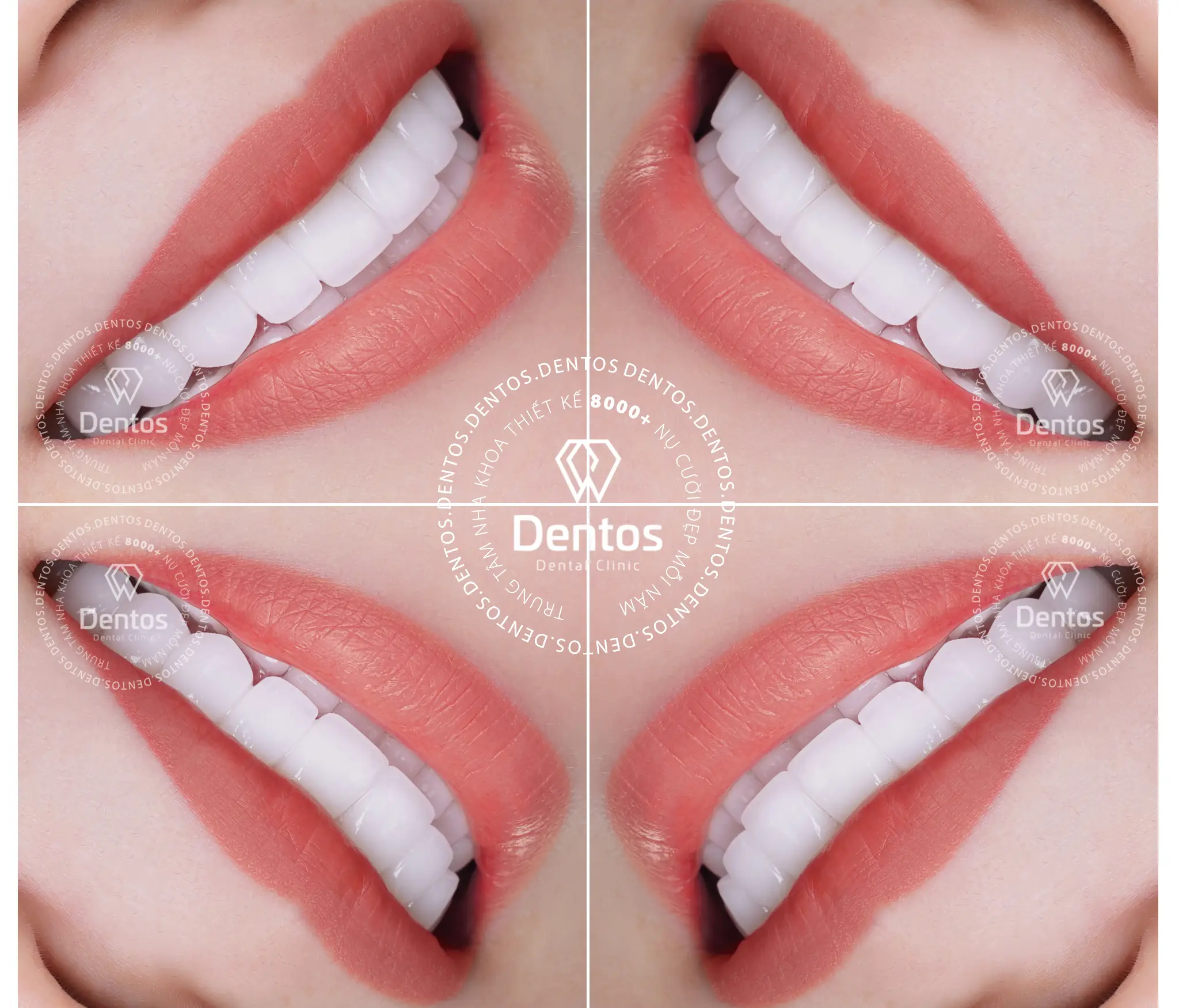 Sứ zirconia của nước nào? Giá bao nhiêu tiền một răng?