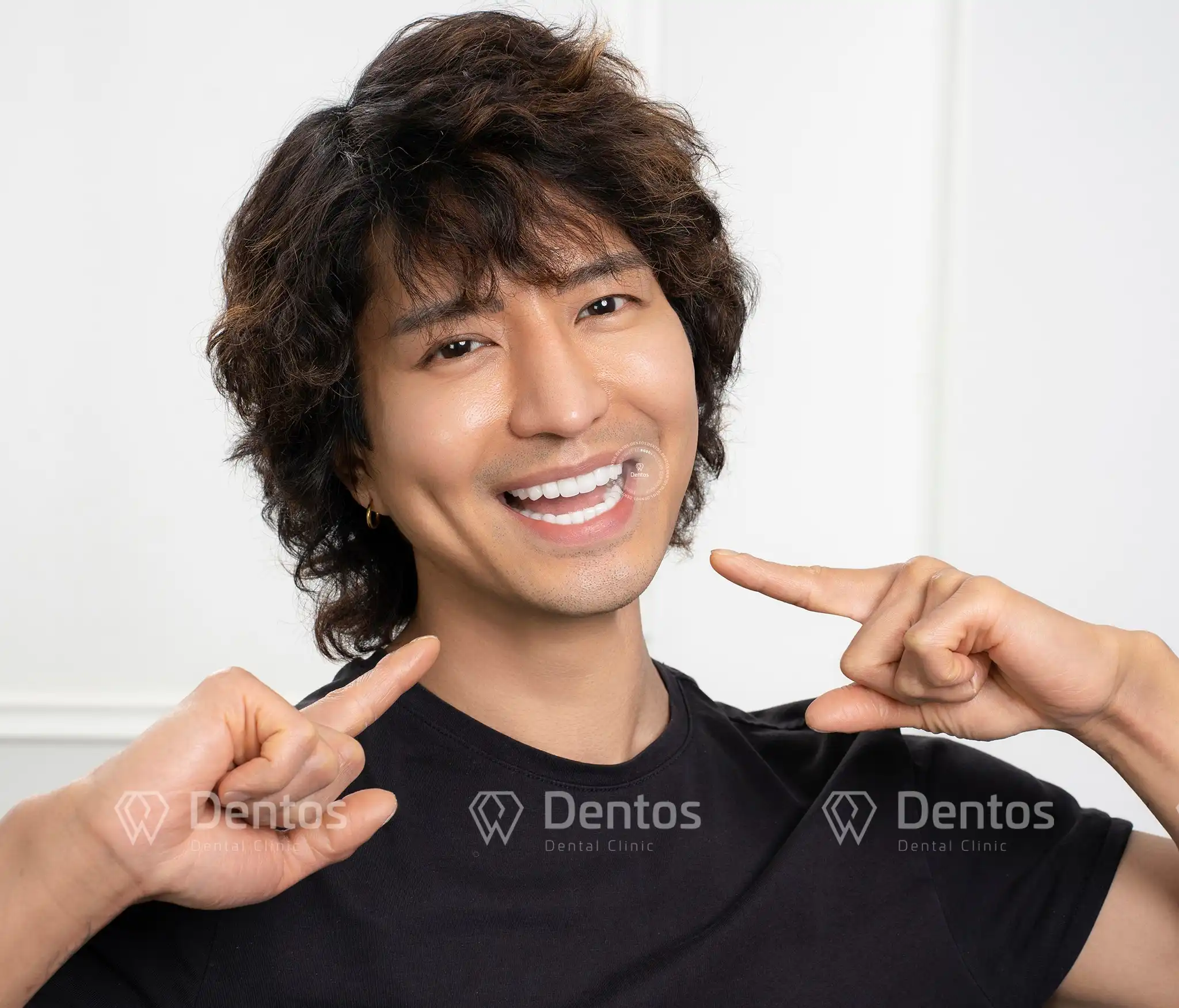 Bọc răng sứ: Những điều cần biết & bảng giá mới nhất 2025