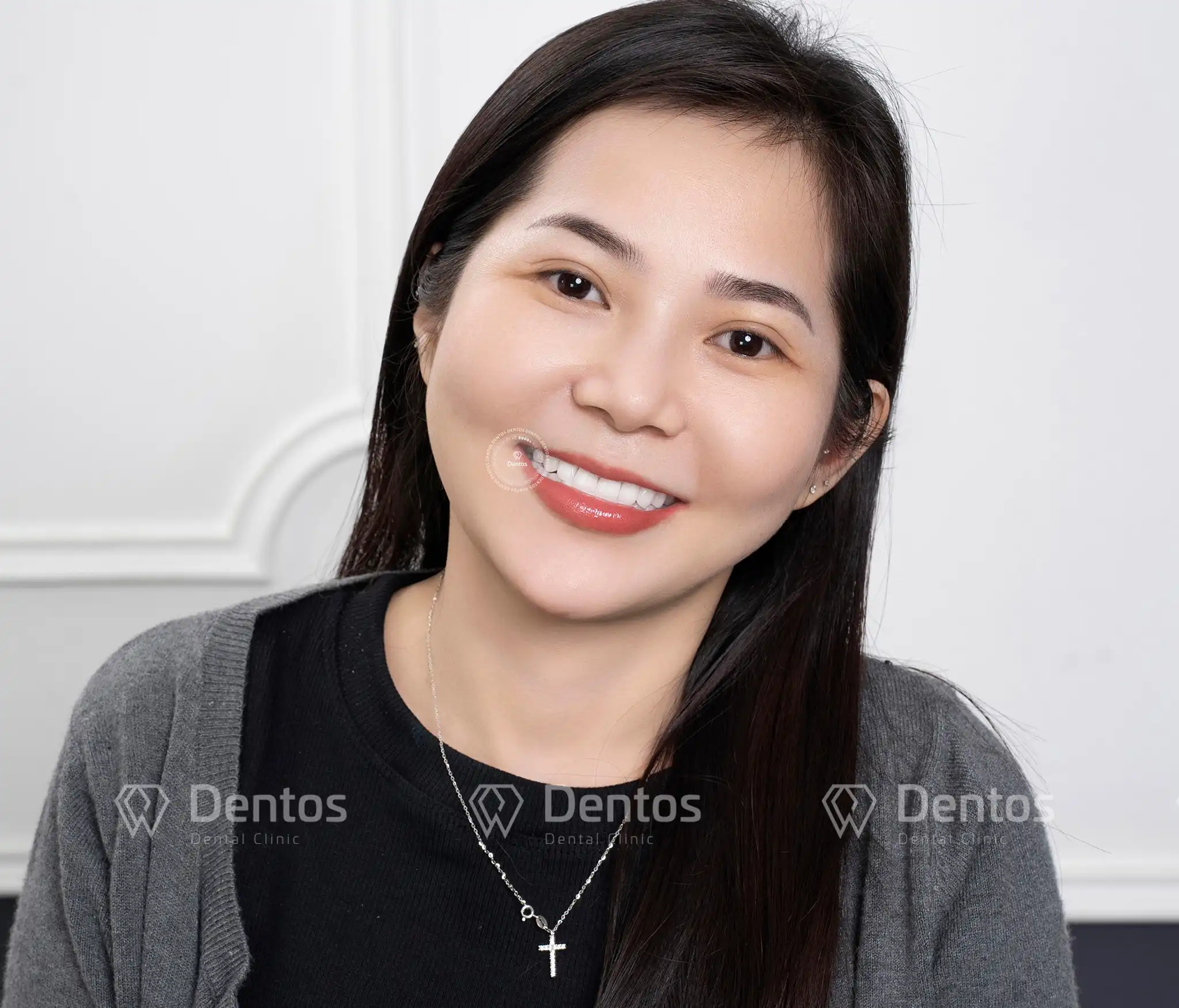 Giá răng sứ bao nhiêu tiền? Làm răng sứ trả góp được không?