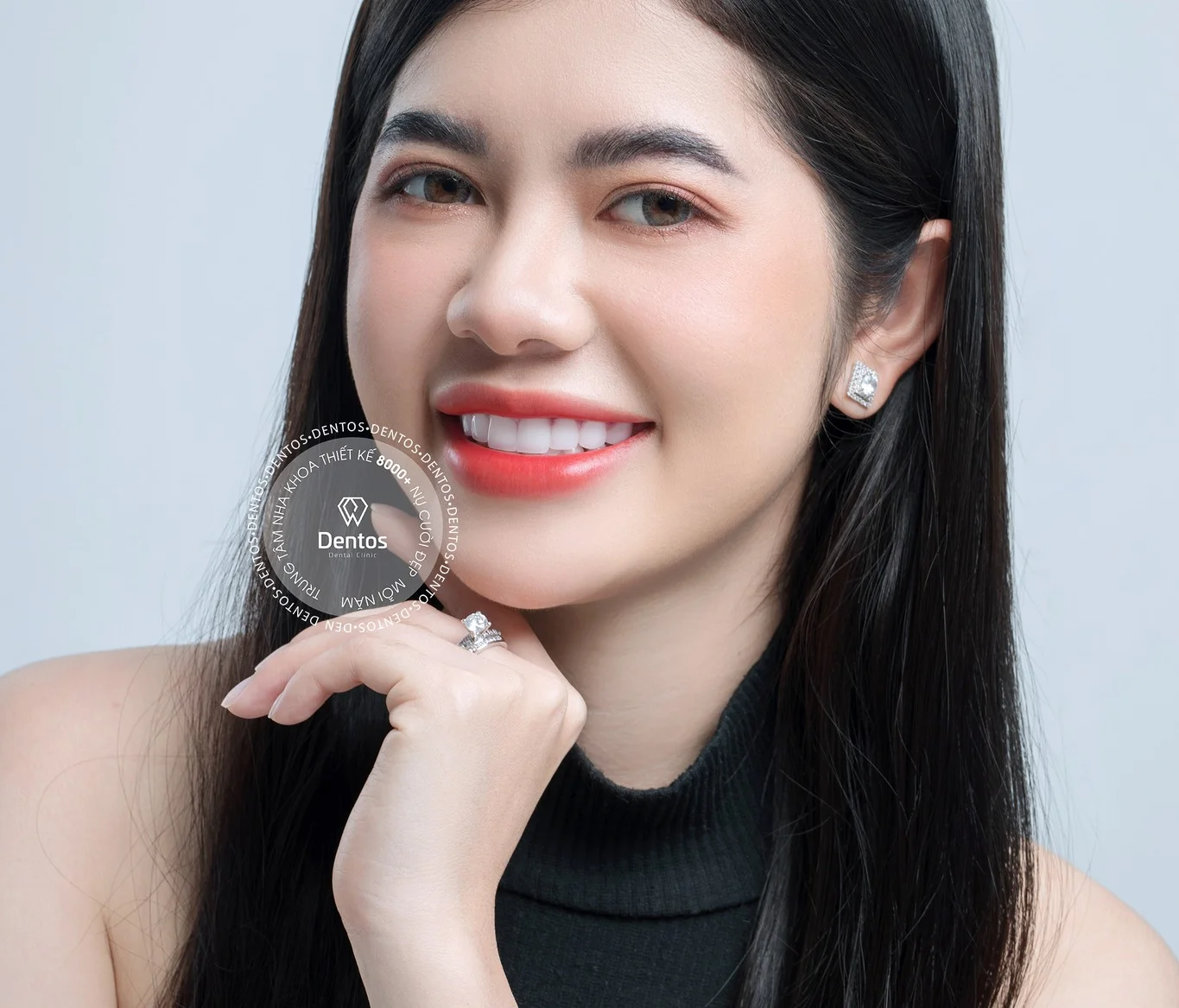 Răng sứ HT Smile: Giải pháp thẩm mỹ cao cấp từ Đức