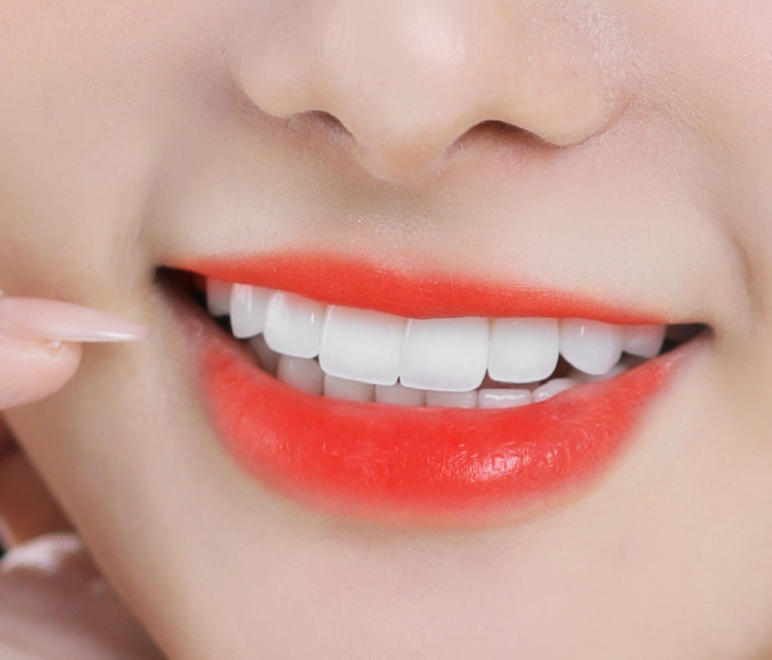 Bọc răng sứ rồi có bị sâu răng không?