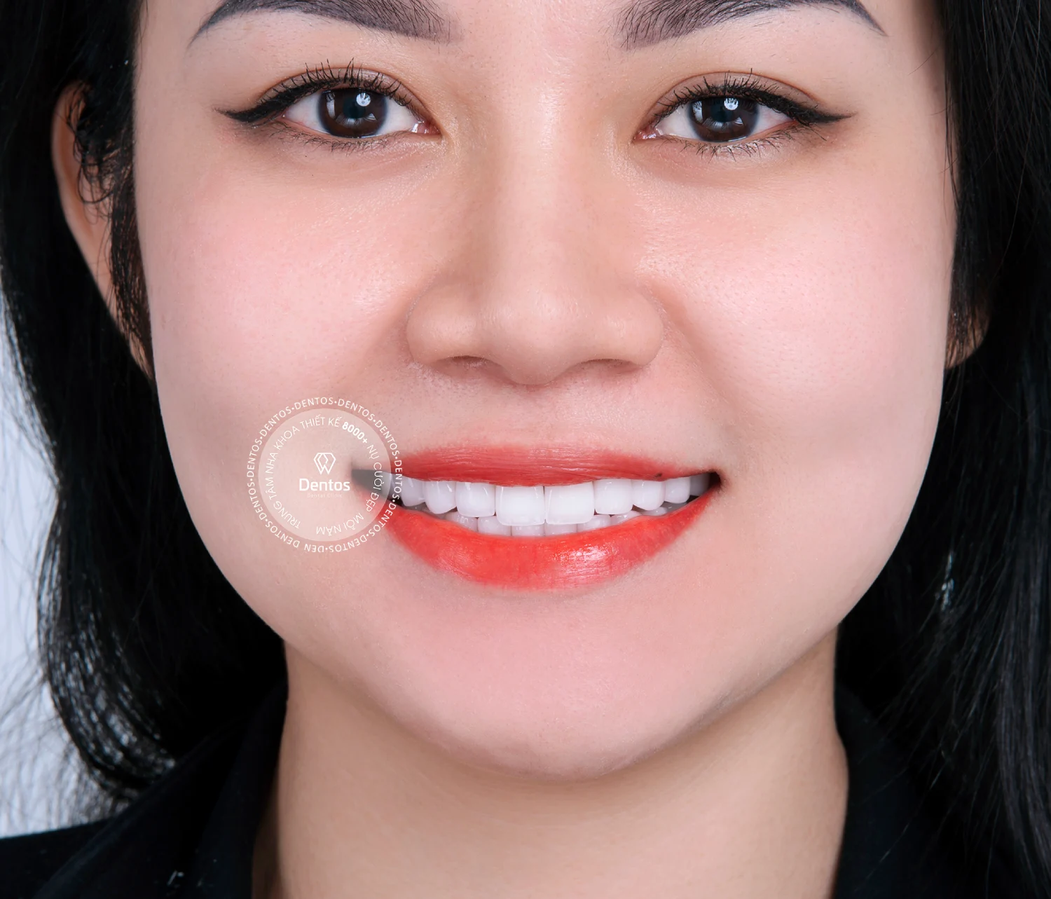 Có nên làm răng sứ không? Lời khuyên từ chuyên gia