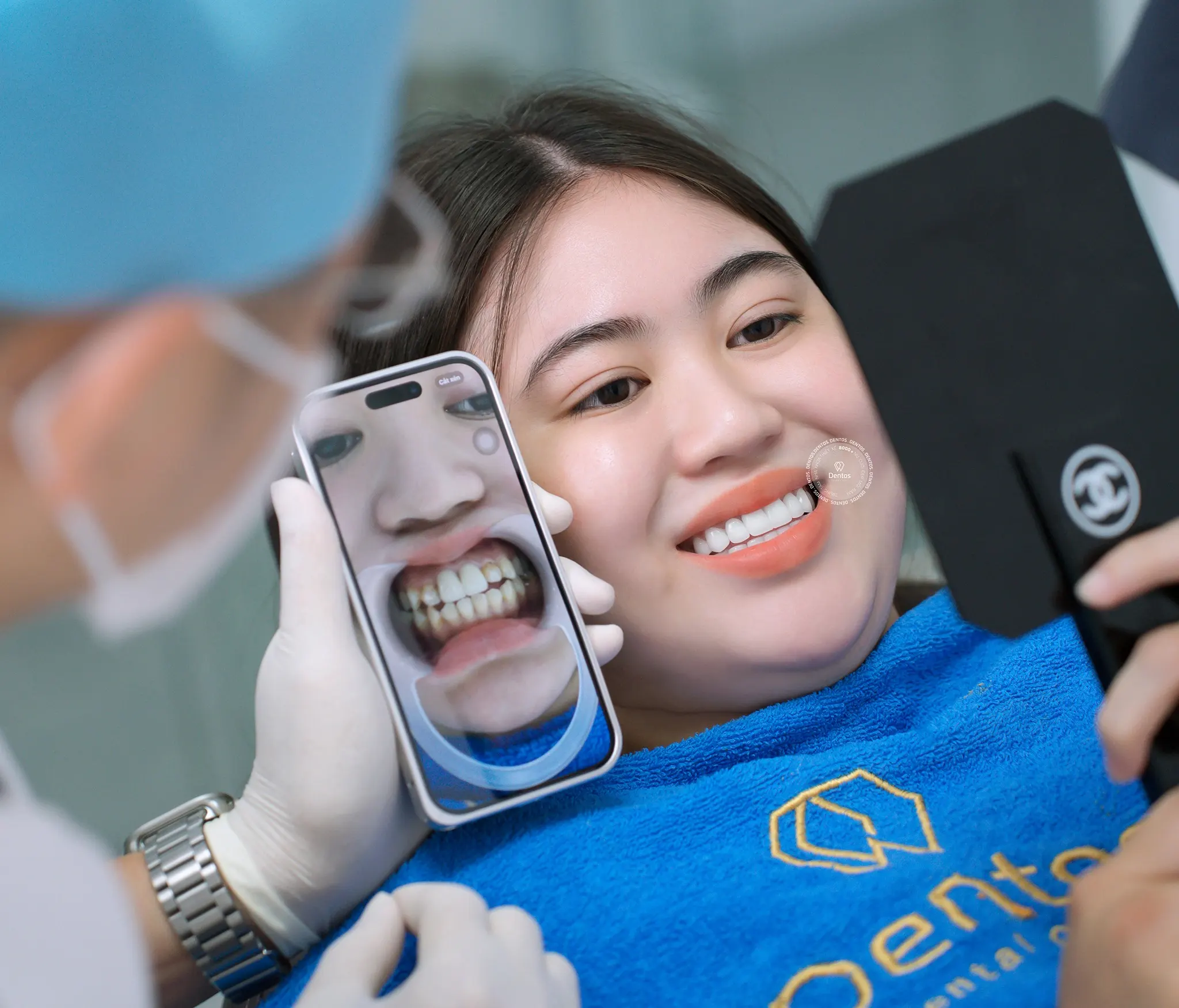 Răng sứ Đức có mấy loại? Giá bao nhiêu tiền?