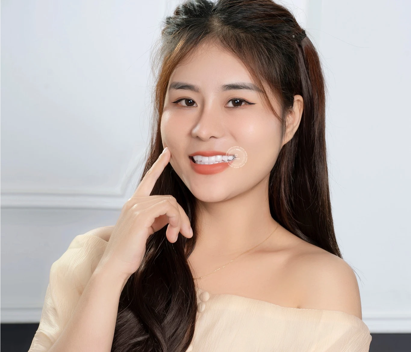 Các dáng răng sứ đẹp tự nhiên, thời trang nhất hiện nay