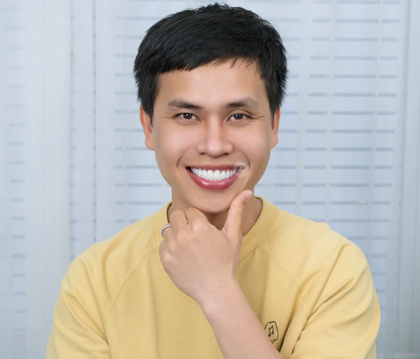 Bọc răng sứ như thế nào? Chi tiết quy trình bọc răng sứ