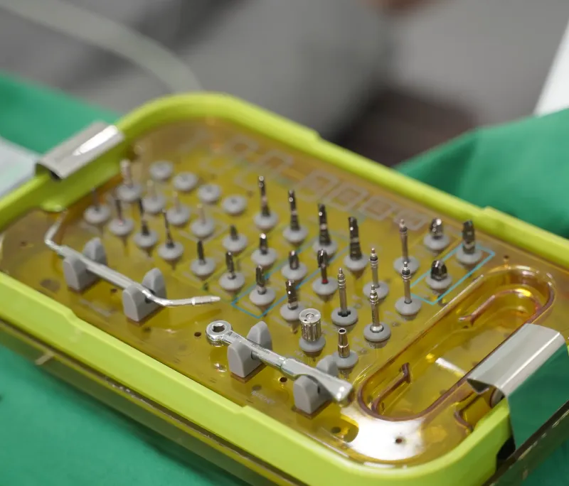 Trồng răng Implant và những điều bạn cần biết