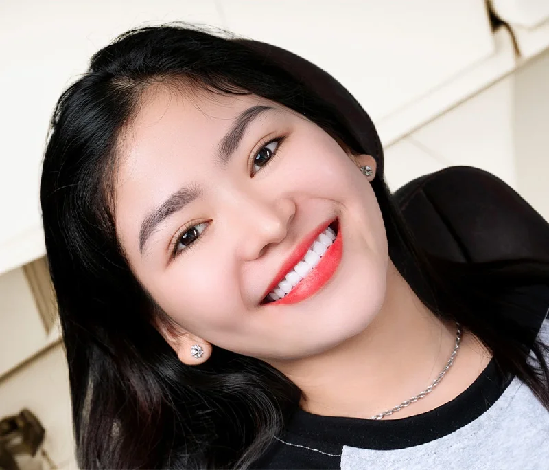 Bọc răng sứ có tẩy trắng được không? Giải đáp chuyên sâu từ Dentos