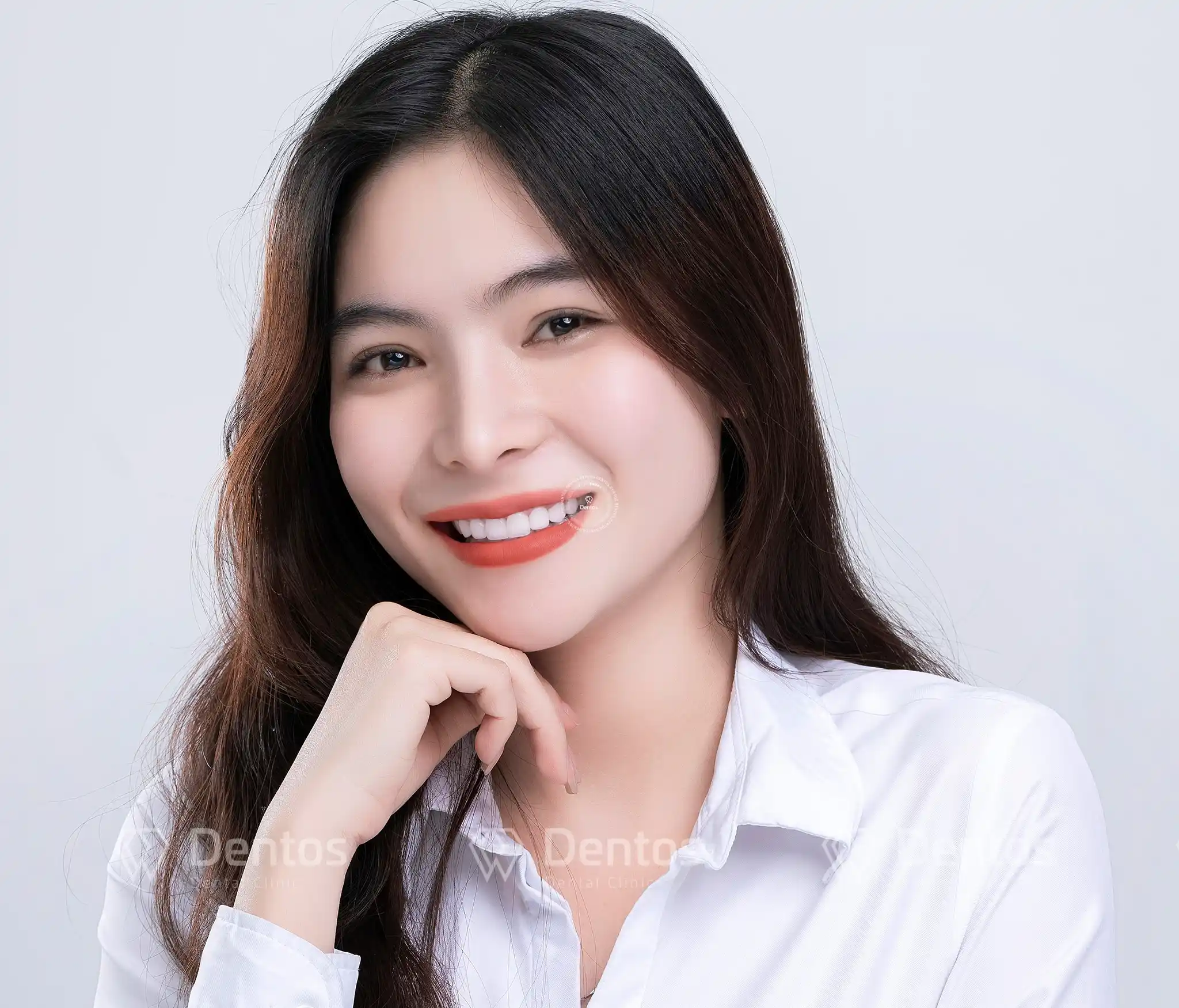 Làm răng sứ bao nhiêu tiền 1 cái? Có phát sinh chi phí gì không?