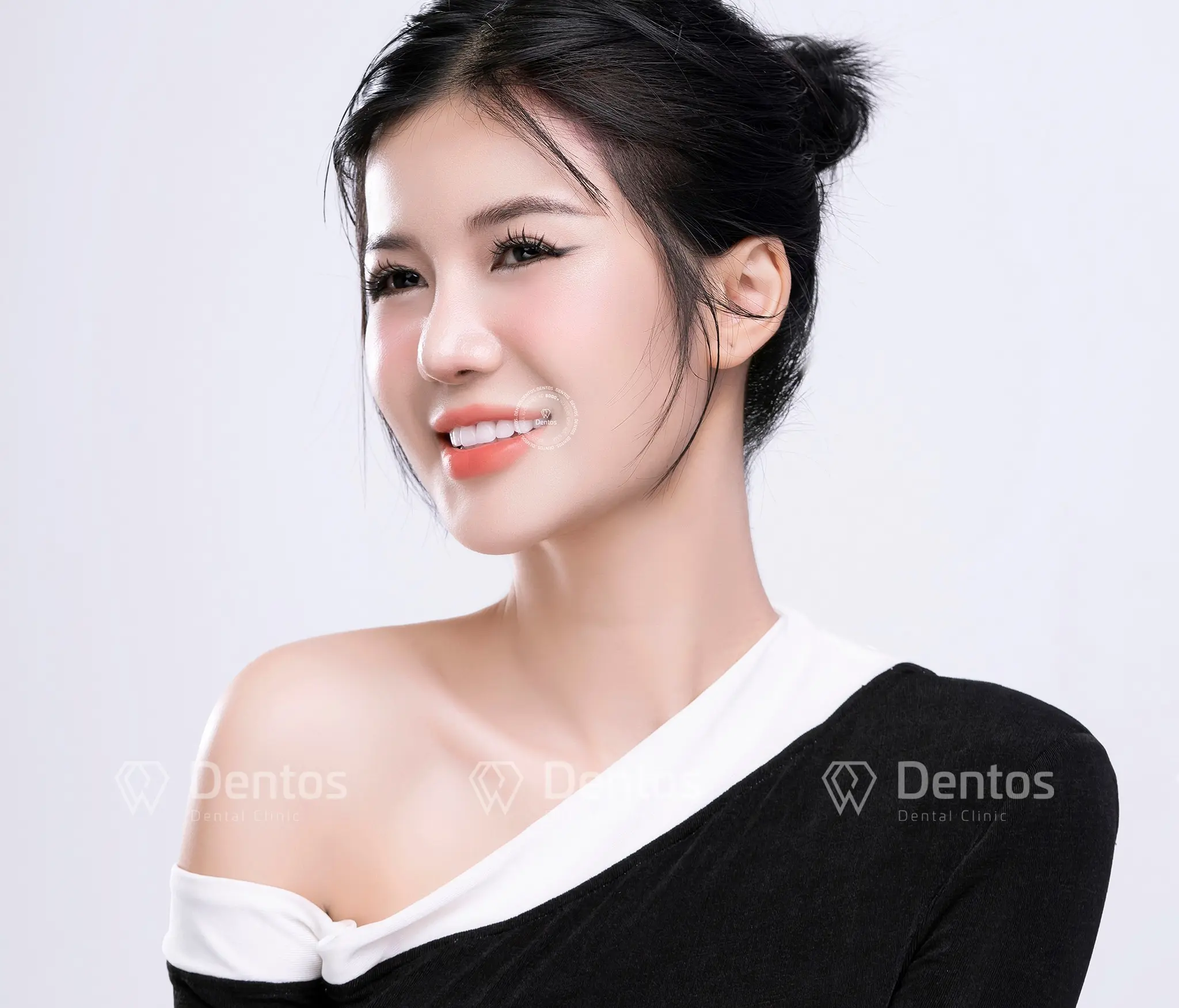 Bọc răng sứ có thay được không?